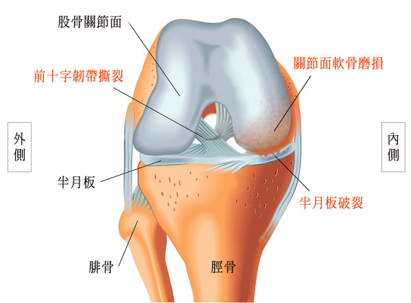 膝關節結構圖