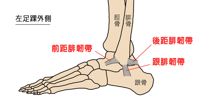 足踝扭傷最常傷及前距腓韌帶