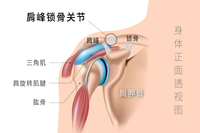 肩峰锁骨关节,肩旋转肌腱撕裂伤和五十肩的病根