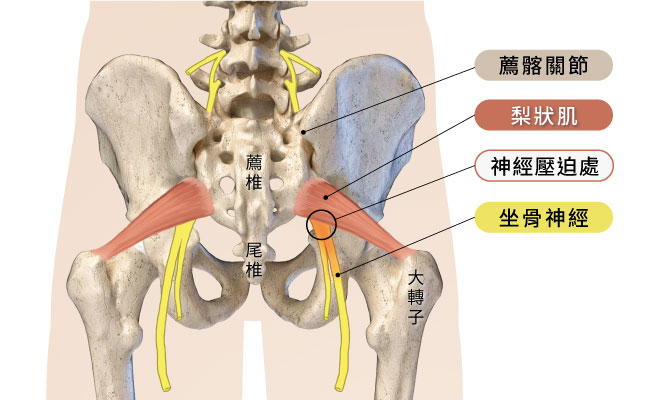 梨状肌的解剖位置图