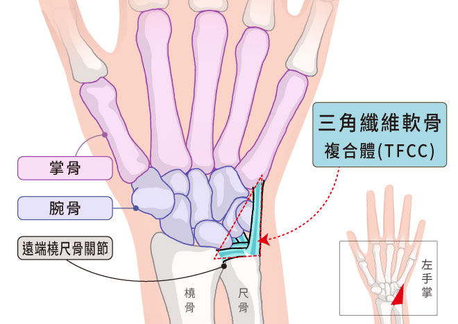 腕關節構造圖