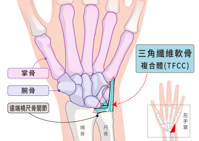 腕关节构造图