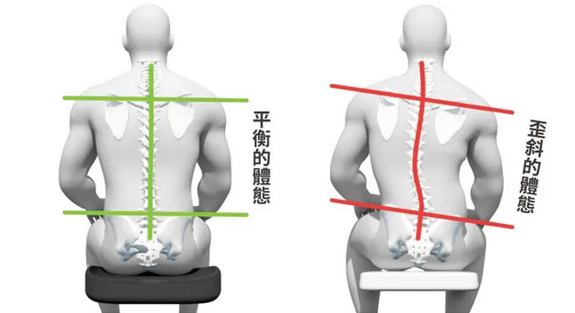 長時間的坐姿不當、腰椎反覆承受不當機械性壓力，導致肌肉攣縮