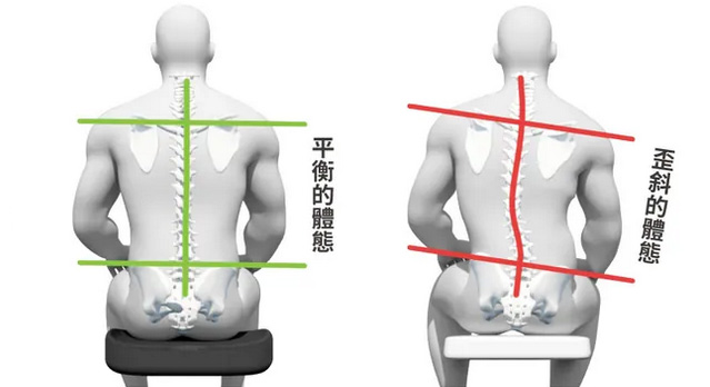 長時間的坐姿不當、腰椎反覆承受不當機械性壓力,導致肌肉攣縮